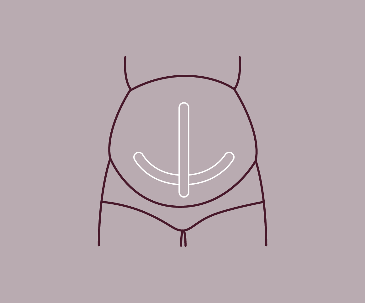 Sling Support #1