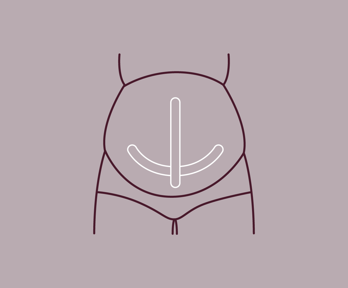 Sling Support #1