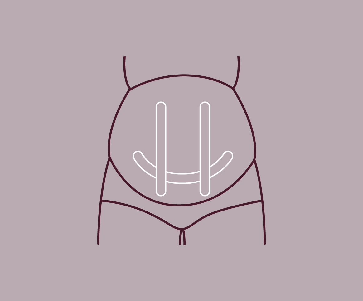 Sling Support #2