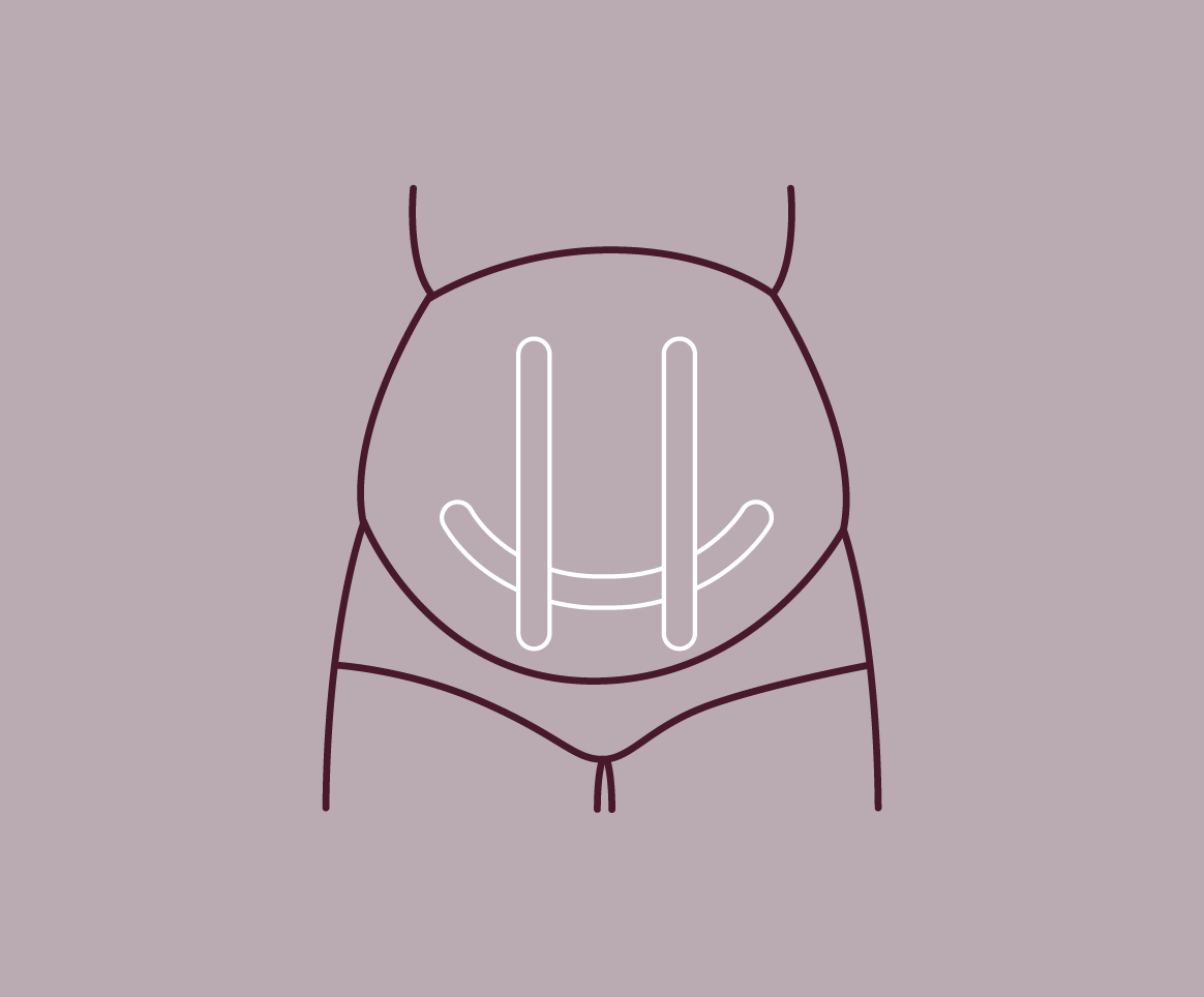Sling Support #2