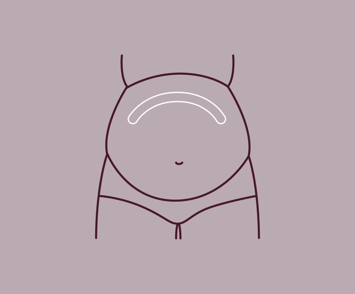Diaphragm Support