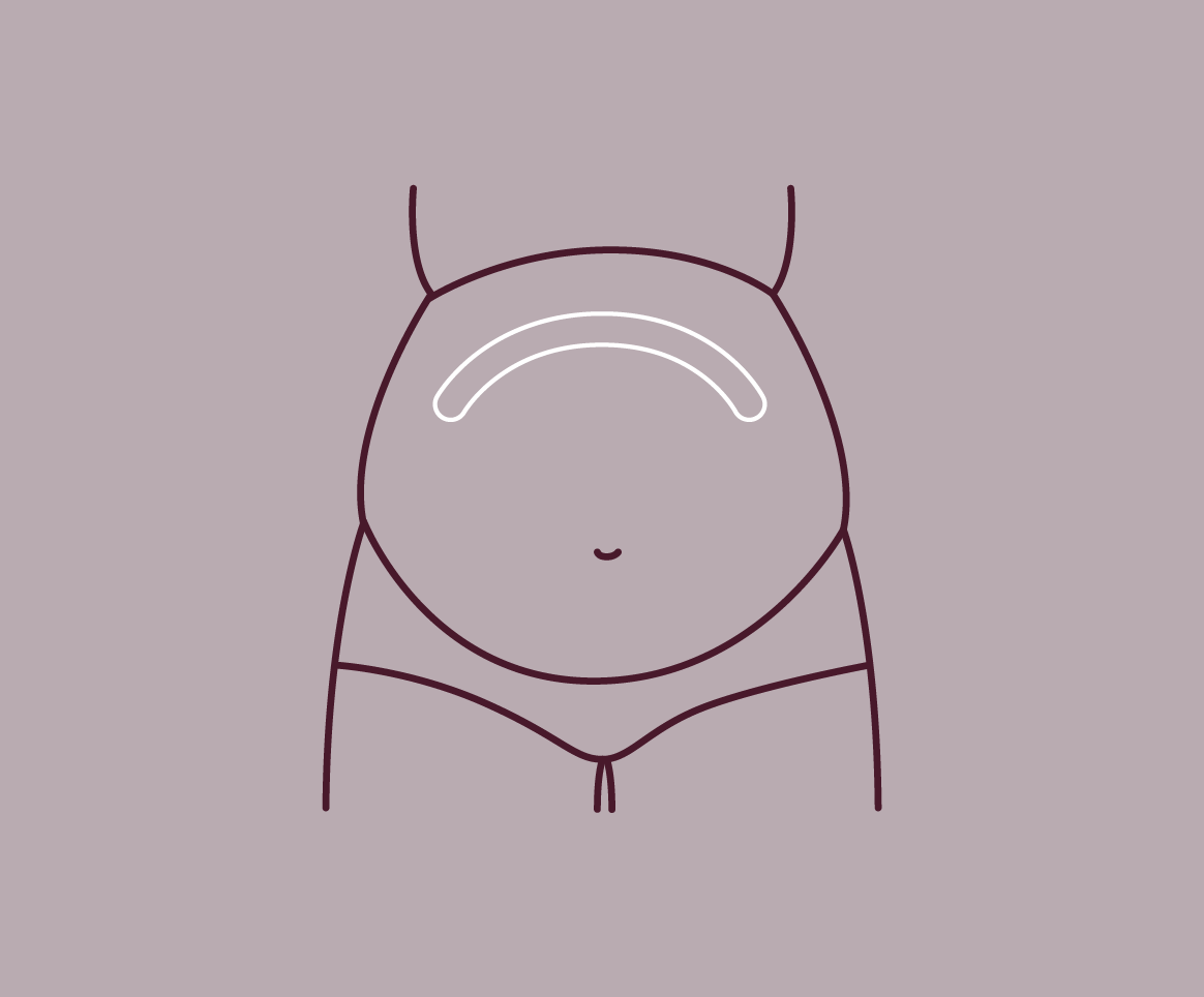 Diaphragm Support